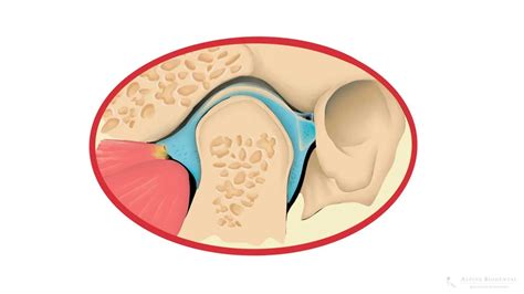 Kiefergelenkschmerzen Ursachen Behandlung Alpine Biodental