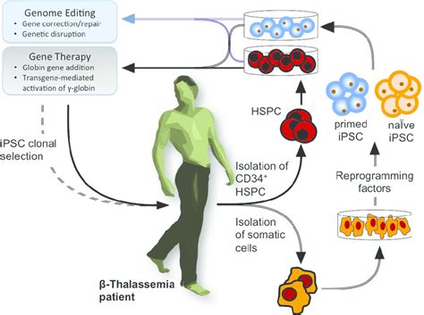 Gene Correction Of Beta Thalassemia Mutations Via Crisprcas9 Technology Vinmec