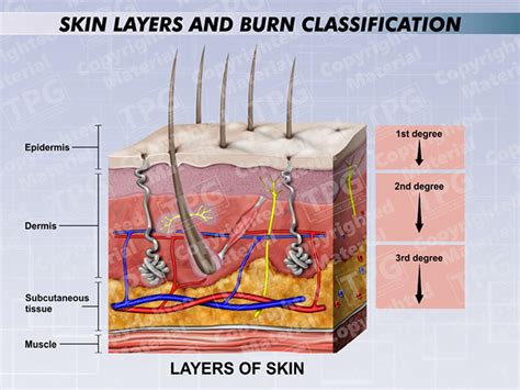 Skin Layers and Burn Classification - Order