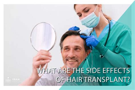 What Are The Side Effects Of Hair Transplant Iran Health Agency