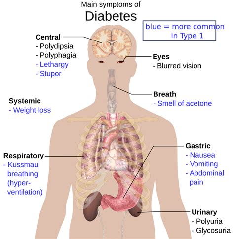 What Is Diabetes Health Talks