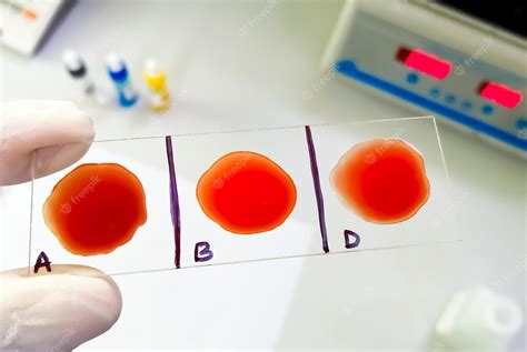 Premium Photo | Blood group and Rh factor testing by slide agglutination method showing O ...