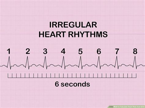 33+ Calculating Rate Ecg - SheikhKiara