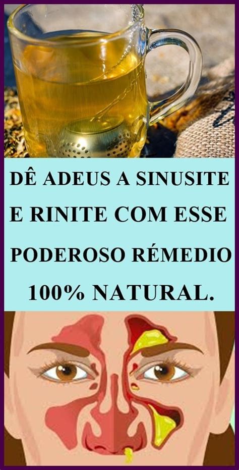 D Adeus Rinite E Sinusite Estes Rem Dios Caseiros Em