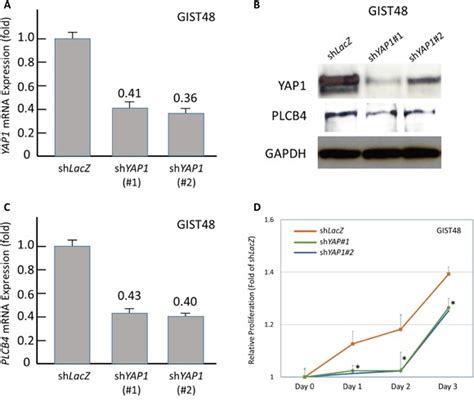 plcb copy gain  plcss overexpression  primary gastrointestinal