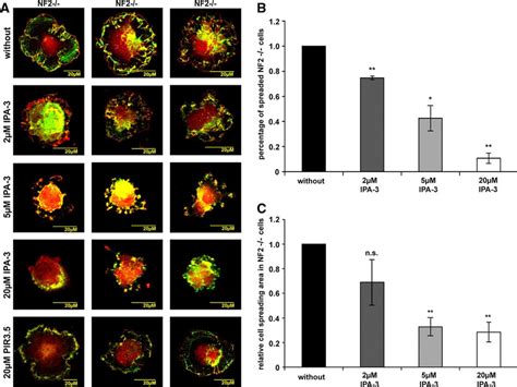 IPA 3 Effect On Cell Spreading In Human Primary Schwannoma Cells