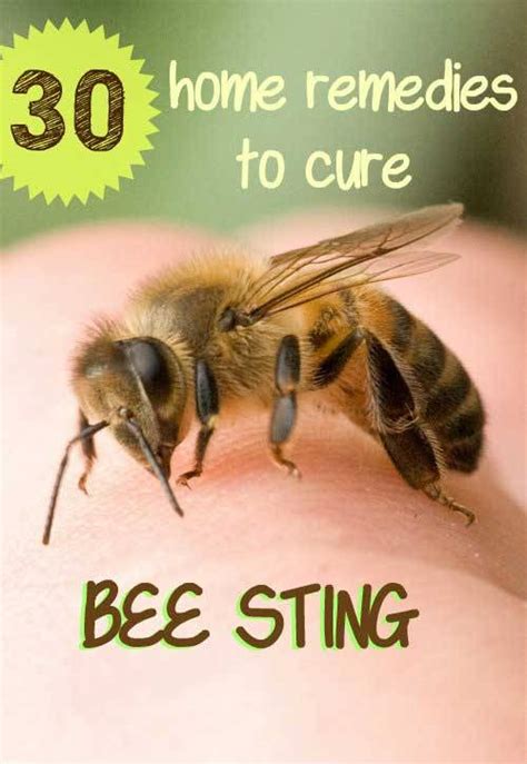 Home Remedy Hacks • 30 Useful Home Remedies To Get Rid Of Bee Sting