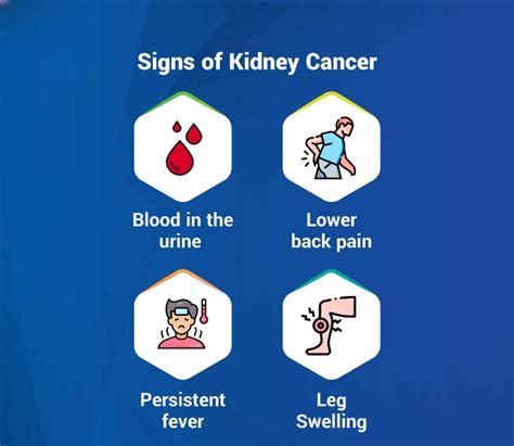 Kidney Cancer Symptoms Diagnosis And Treatment By Dr Naresh Kumar