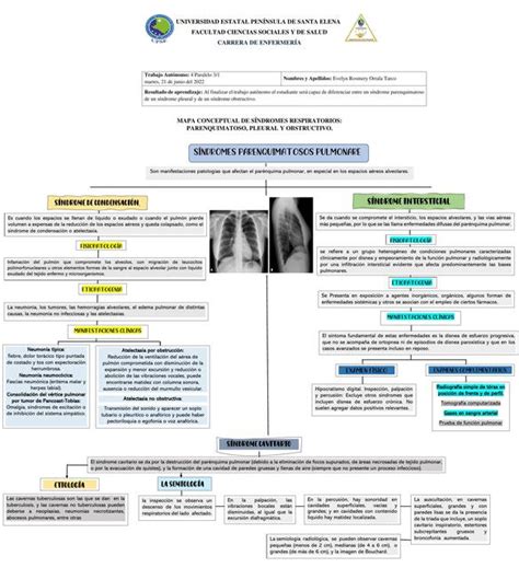 Síndromes Respiratorios Parenquimatosos Pleurales y Obstructivos