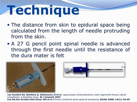 Ppt Segmental Thoracic Spinal Anesthesia Powerpoint Presentation