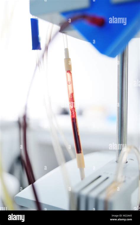 procedure plasmapheresis - the procedure of purification of blood and plasma Stock Photo - Alamy