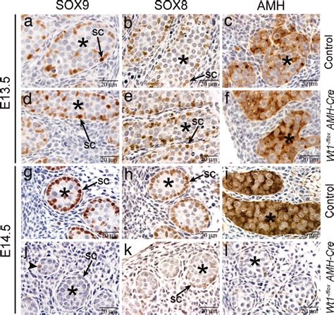 The Wilms Tumor Gene Wt1 Is Required For Sox9 Expression And