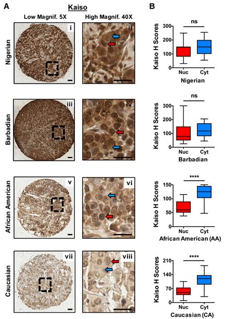 Kaiso Subcellular Localization And Expression In Nigerian Barbadian