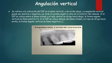 Tecnicas Radiograficas Intrabucales Ppt