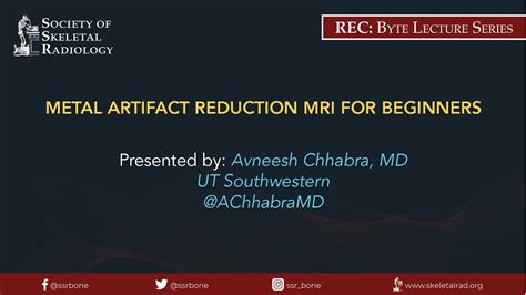 Metal Artifact Reduction Mri For Beginners Youtube