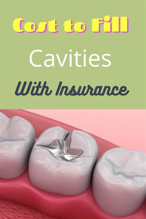 Cost Of Filling A Cavity With And Without Dental Insurance Dental