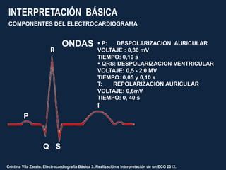 Electrocardiograma Para Estudio De Medicina Ppt