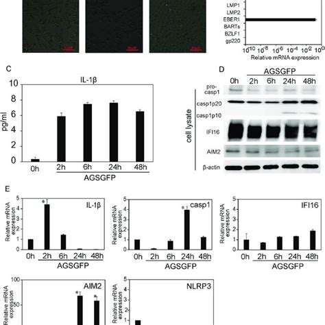 Ebv Infection In Thp 1 Jurkat And Bjab Cells A Confocal Download Scientific Diagram