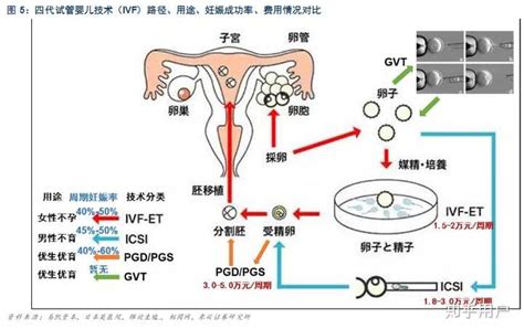 辅助生殖包括哪些？ 知乎