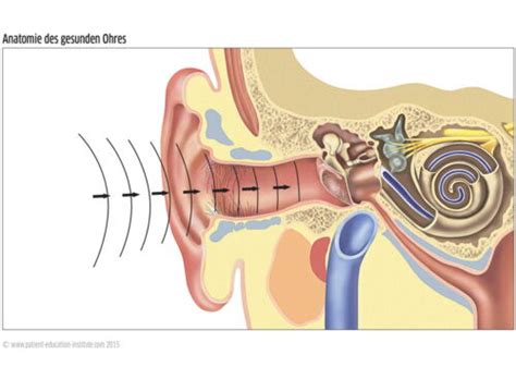 Tinnitus und mögliche Therapien HNO Praxis Sarnen