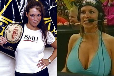 Stephanie Mcmahon Before And After Surgery