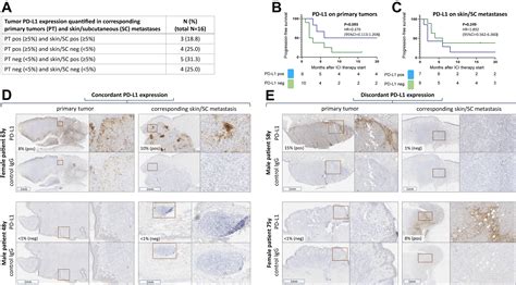 Correlation Of Tumor PD L1 Expression In Different Tissue Types And