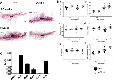 CCR2 Does Not Control Branching Morphogenesis Within The Developing