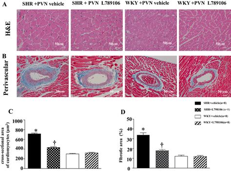 Effects Of L 798106 Infusion On Cardiac Hypertrophy In The SHRs And