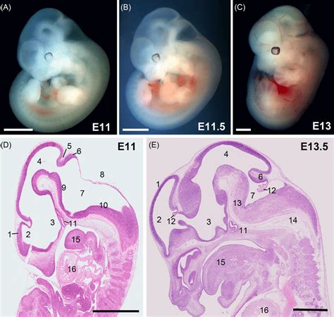 1 Early Brain Morphogenesis A C Whole Live Embryos E11 E13 D E