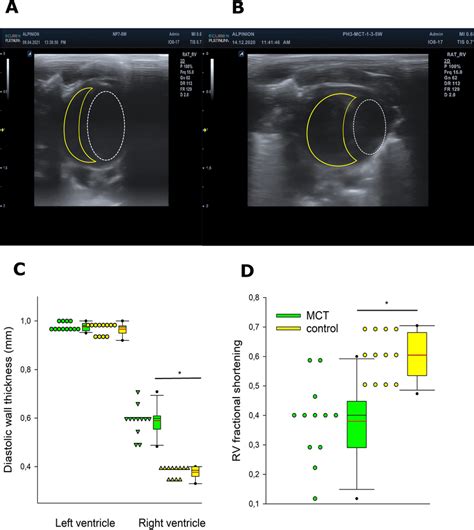 Echocardiographic Characterization Of Rats With Monocrotaline Induced