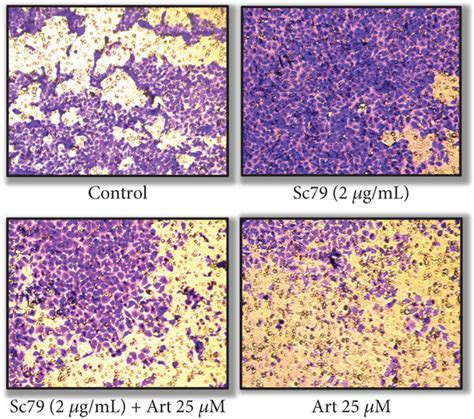 Treatment Of Cells With An Akt Activator Sc79 Attenuated The