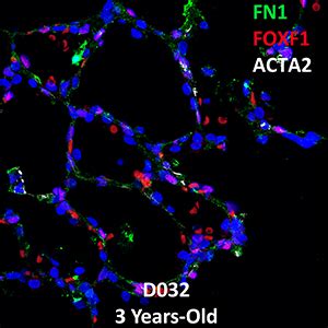 Year Old Human Lung Confocal Imaging Donor D Fn Foxf And Acta