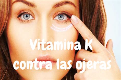 Vitamina K para eliminar las incómodas bolsas y ojeras