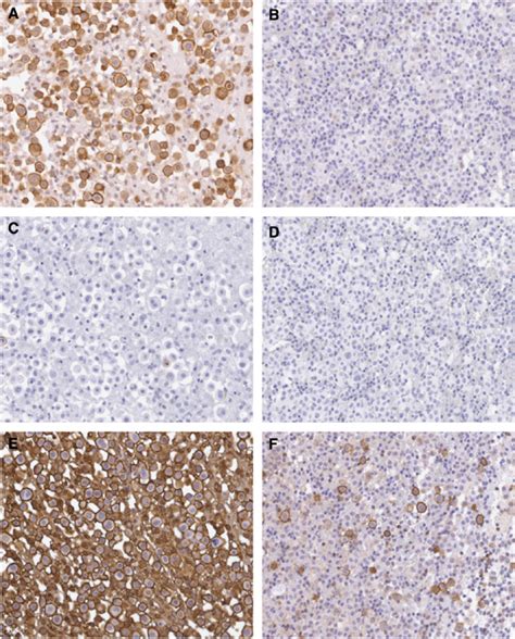 Immunohistochemical Staining For Muc1ema On Sections Of Formalin Fixed Download Scientific