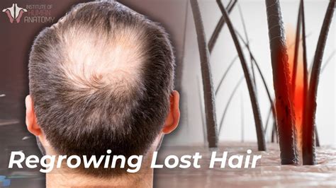 Understanding Male Pattern Hair Loss: Prevention and Regrowth Strategies