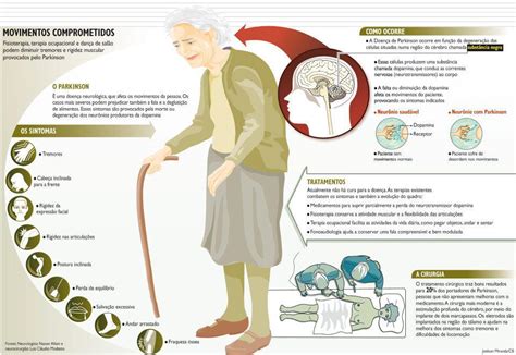 Fisioterapia Reabilita O Fisioterapia Na Doen A De Parkinson