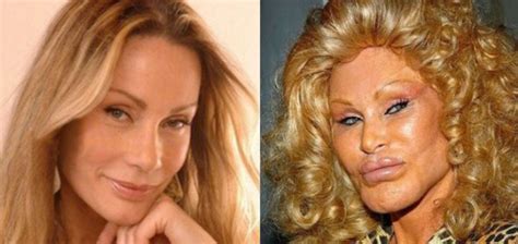 Used To Be Such A Beauty How The Famous Plastic Surgery Aficionado