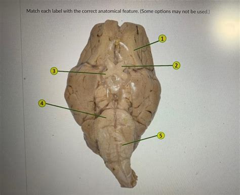 Solved Options Include Optic Tract Olfactory Bulb Optic Chegg