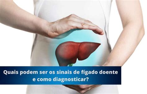 Quais podem ser os sinais de fígado doente e como diagnosticar Blog