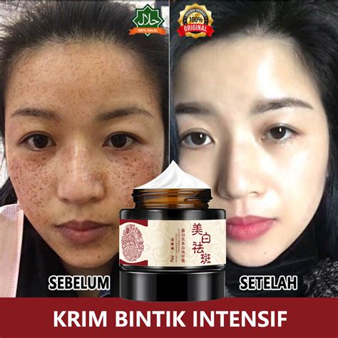 Jual Cream Penghilang Flek Hitam Krim Pemutih Wajah Krim Penghilang