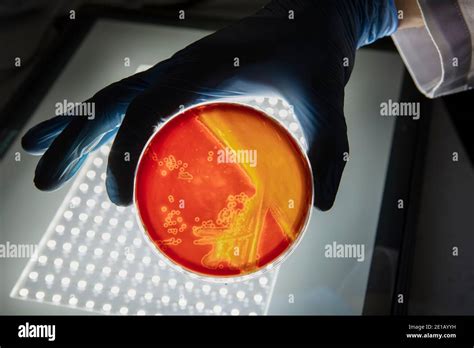 Growing Bacteria In Agar Medium In Microbiology Lab Making Streak In A