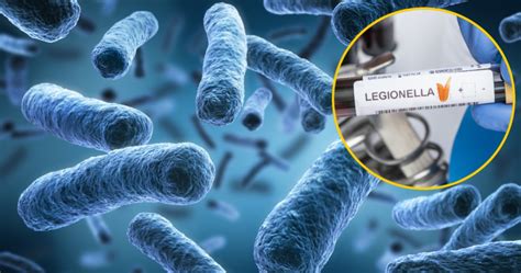 Legionella w Polsce Jak się chronić przed legionellą Geekweek w