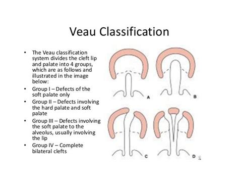 Cleft lip and palate