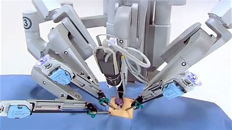 Robot Surgeons Are The Future Of Medicine Youtube