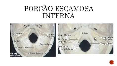 Forame De Panizza - Anatomia do forame magno | PPTX