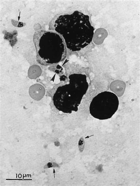 Tachyzoites Of T Gondii A Dividing Tachyzoite Arrowheads And Single Download Scientific