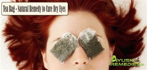 8 Beneficial Home Remedies For Dry Eyes One Must Try