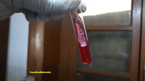 Triple Sugar Iron Tsi Agar Test Introduction Composition Princ