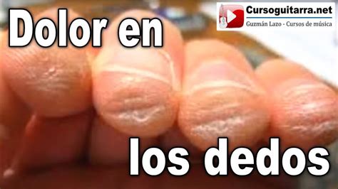 Dolor En Los Dedos Al Tocar Guitarra Lecci N Youtube