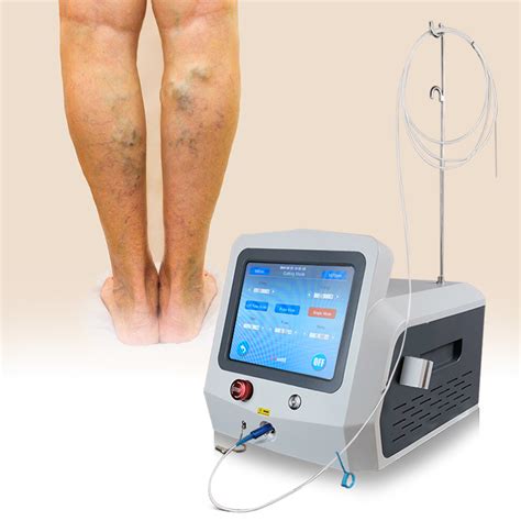 Nm Evlt Laser Diode Endovenous Laser Ablation Of Varicose